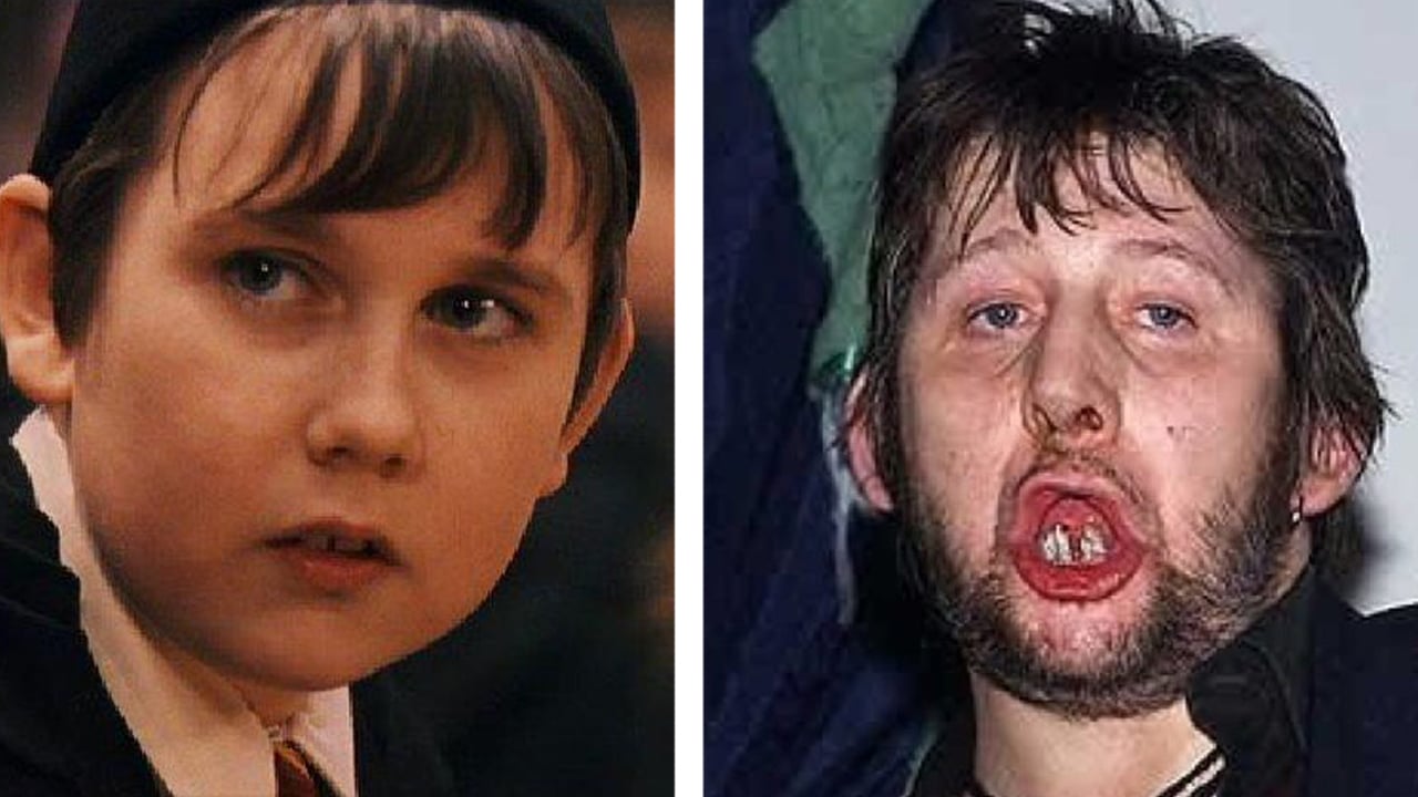 Artistic Hollywood Star Now Homeless After Scandals Artwork Art Artistic Hollywood Star Now Homeless After Scandals Artwork Art